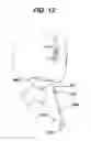 Fig. 09 - Tongue suspension device and method