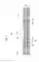 Fig. 07 - HEAT EXCHANGER FOR VEHICLE