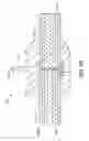 Fig. 09 - Liquid-chromatography conduit assemblies having high-pressure seals