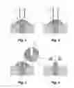Fig. 02 - DEVICES AND METHODS FOR SEVERING FASTENER HEADS