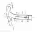 Fig. 01 - INFLATABLE EAR PIECE WITH PRESSURE RELIEF VALVE