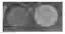 Fig. 01 - Catalyst, catalytic converter, and method for the production thereof