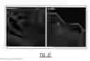 Fig. 30 - Injectable dendrimer hydrogel nanoparticles
