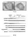 Fig. 16 - METHODS OF TREATING CANCER