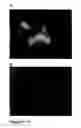 Fig. 13 - Pulmonary administration of immunoglobulin single variable domains and constructs thereof