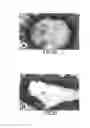 Fig. 03 - Methods, compositions and kits relating to chitnases and chitnase-like molecules and inflammation disease
