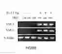 Fig. 11 - Methods, compositions and kits relating to chitnases and chitnase-like molecules and inflammation disease