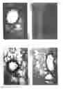 Fig. 12 - Methods, compositions and kits relating to chitnases and chitnase-like molecules and inflammation disease