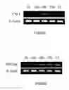 Fig. 17 - Methods, compositions and kits relating to chitnases and chitnase-like molecules and inflammation disease