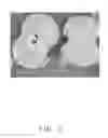 Fig. 22 - Lithium ion phosphate hierarchical structure, method for making the same, and lithium ion battery using the same