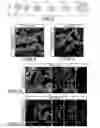 Fig. 07 - Methods and systems for converting precursor cells into intestinal tissues through directed differentiation