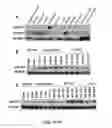 Fig. 08 - MicroRNA Expression Abnormalities in Pancreatic Endocrine and Acinar Tumors
