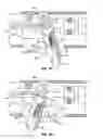 Fig. 07 - ABLATION DEVICE WITH ARTICULATED IMAGING TRANSDUCER