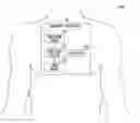 Fig. 01 - Method and apparatus for detecting atrial filling pressure