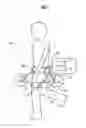Fig. 02 - Walking assist device