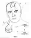 Fig. 02 - Brain stimulation programming