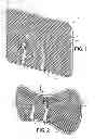Fig. 02 - Deployable garment venting device