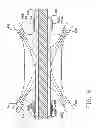 Fig. 07 - Global rapid transit infrastructure using linear induction drive