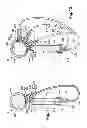 Fig. 07 - Fluid injection device, and mechanical system equipped with such a device