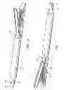 Fig. 15 - Surgical stapling apparatus including sensing mechanism