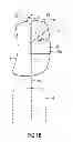 Fig. 03 - Headrest speaker arrangement