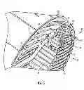 Fig. 03 - Stator including conductors provided with a composite sleeve
