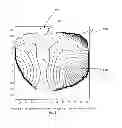 Fig. 09 - Progressive reading and intermediate distance lens defined by employment of a zernike expansion