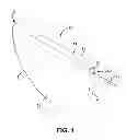 Fig. 02 - Wet electrolytic capacitor containing a gelled working electrolyte