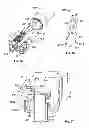 Fig. 19 - Finger protection for 90° header