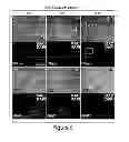 Fig. 12 - Compositions, kits and methods for treatment of complement-related disorders