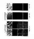 Fig. 16 - Compositions, kits and methods for treatment of complement-related disorders