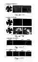 Fig. 20 - Compositions, kits and methods for treatment of complement-related disorders