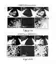 Fig. 27 - Compositions, kits and methods for treatment of complement-related disorders