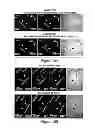 Fig. 32 - Compositions, kits and methods for treatment of complement-related disorders