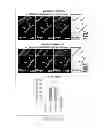 Fig. 33 - Compositions, kits and methods for treatment of complement-related disorders