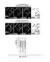 Fig. 34 - Compositions, kits and methods for treatment of complement-related disorders