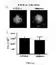 Fig. 38 - Compositions, kits and methods for treatment of complement-related disorders