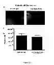 Fig. 39 - Compositions, kits and methods for treatment of complement-related disorders