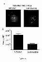 Fig. 40 - Compositions, kits and methods for treatment of complement-related disorders