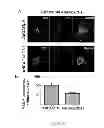 Fig. 41 - Compositions, kits and methods for treatment of complement-related disorders