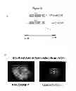 Fig. 42 - Compositions, kits and methods for treatment of complement-related disorders