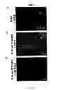 Fig. 44 - Compositions, kits and methods for treatment of complement-related disorders