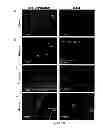 Fig. 45 - Compositions, kits and methods for treatment of complement-related disorders