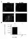 Fig. 46 - Compositions, kits and methods for treatment of complement-related disorders