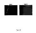Fig. 47 - Compositions, kits and methods for treatment of complement-related disorders