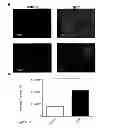 Fig. 48 - Compositions, kits and methods for treatment of complement-related disorders