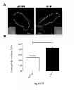 Fig. 49 - Compositions, kits and methods for treatment of complement-related disorders