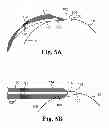Fig. 07 - Surgical articles and methods for treating pelvic