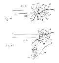 Fig. 09 - Surgical articles and methods for treating pelvic