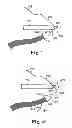 Fig. 10 - Surgical articles and methods for treating pelvic